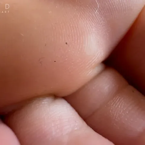 Nikemd